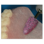 Repasado Resinas Rubynit, Pulidores Dentales Laboratorios Abrasivos Resinas y Prótesis