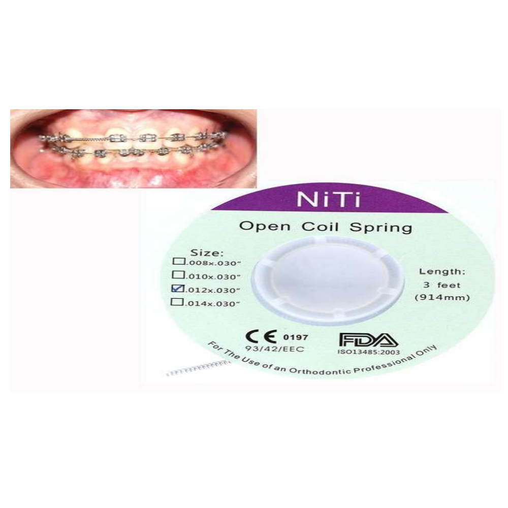 Muelles NITI (Rollo) (Abrir Espacio-Open Spring),Ortodoncia Dental
