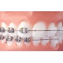 Brackets Cerámica 20 Uds. Roth-MBT  0.22-0.18, Ortodoncia Dental