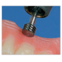 Asperizar y Crear Retenciones  Prótesis Acrílicas C108, Fresas Laboratorios Dentales Carburo de Tungsteno